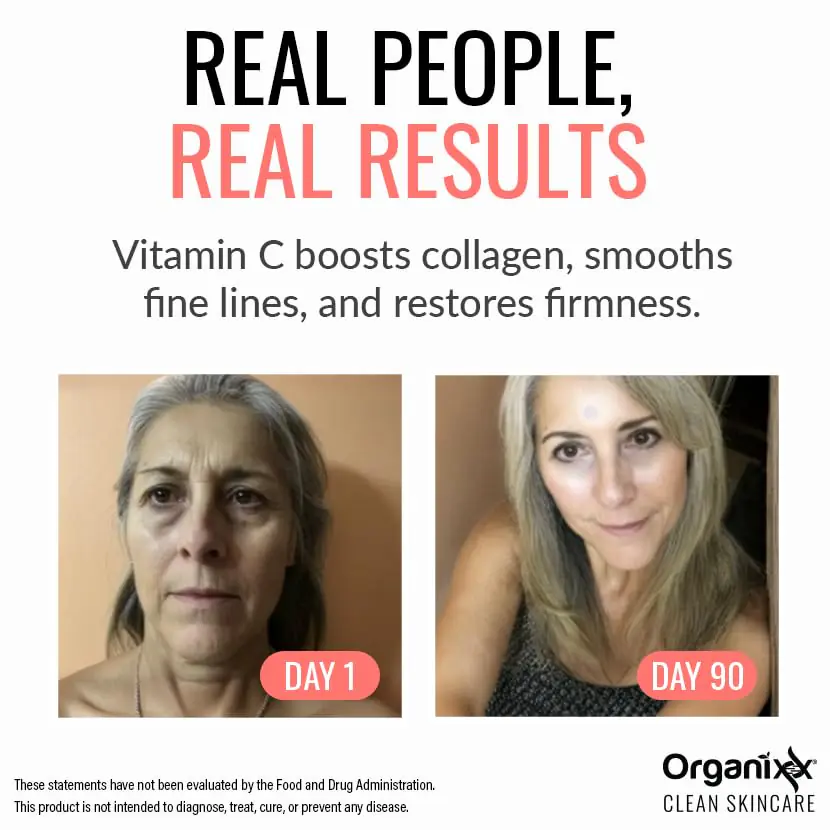 Vitamin C serum for anti aging and wrinkle reduction