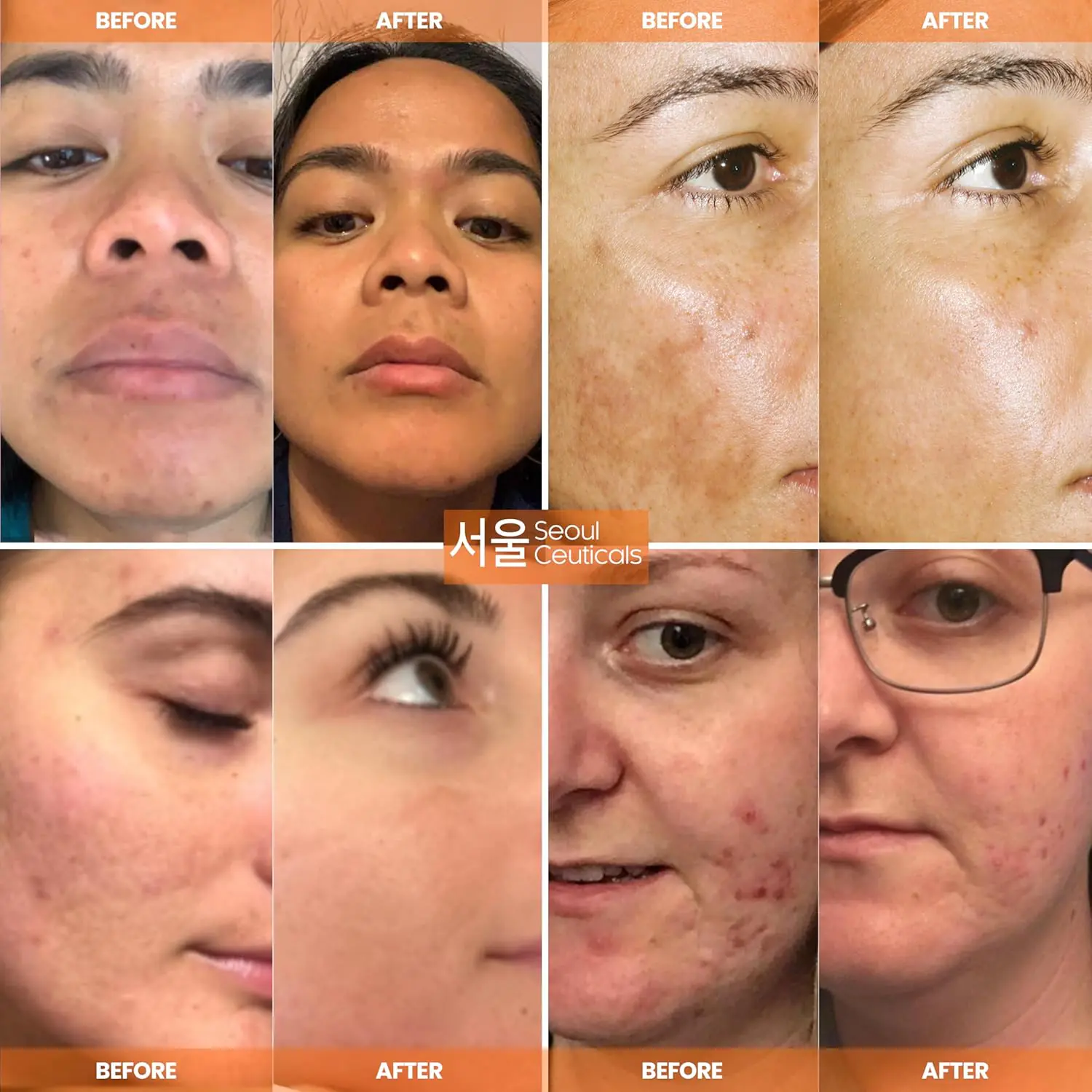 Vitamin C serum with ferulic acid for face