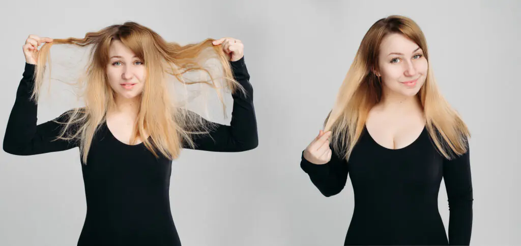hair fall causes