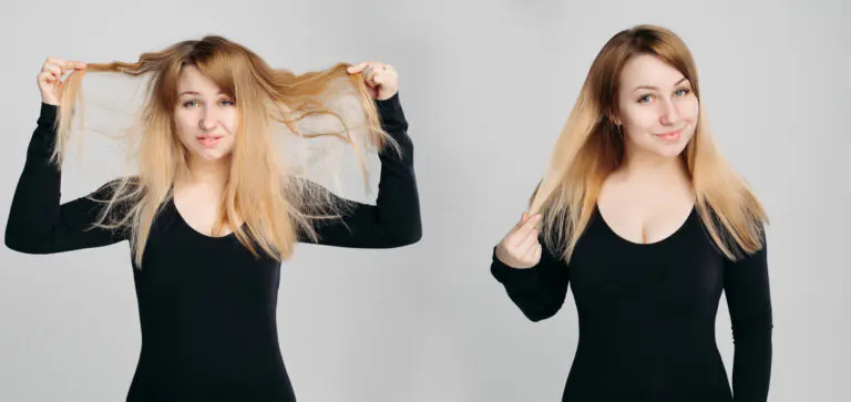 hair fall causes